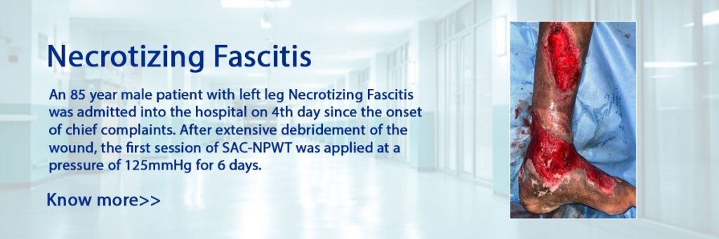Necrotizing-Fascitis-1200x400_c
