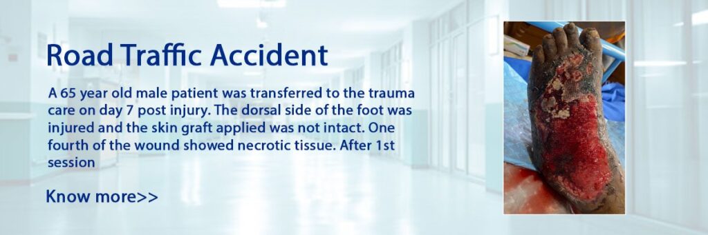 Road-Traffic-Accident-1200x400_c